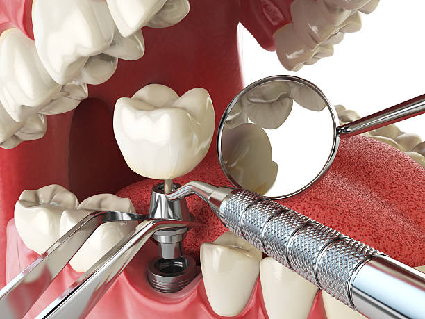 Best Weekend Emergency Dentist in Salmon, ID